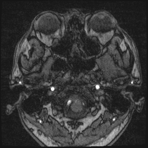 Click on the Serie image to view the images of VILLANUEVA, WILLIAM A.